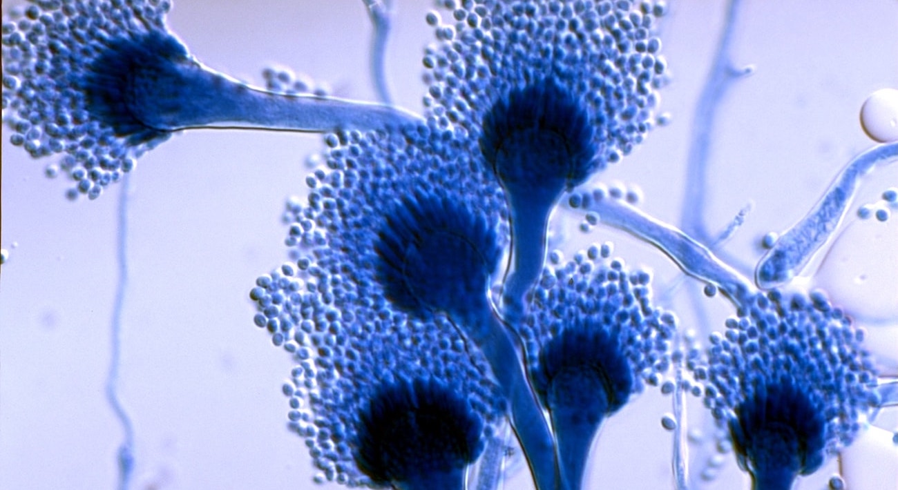Aspergillus Fumigatus Under Microscope My Xxx Hot Girl