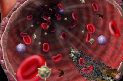 ebola virus traitement plasma convalescent