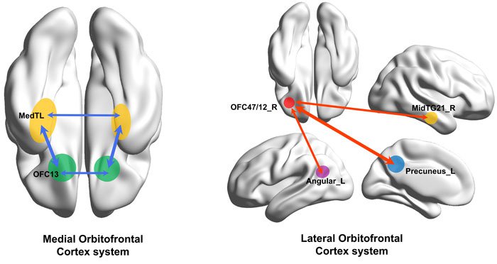 cerveau dépression cause physique
