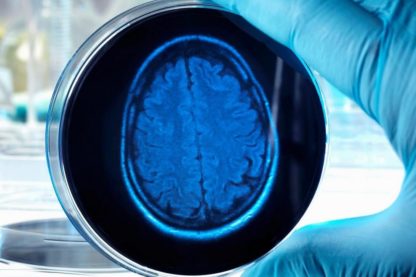 cerveaux humains culture élevage étude biologie médecine