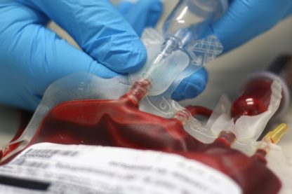 sac de sang artificiel don médecine cellules souches globules rouges