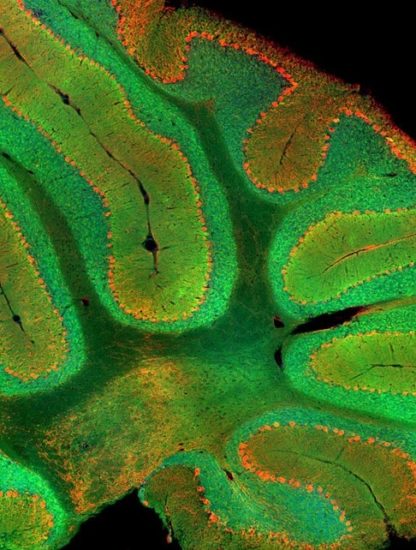 cervelet protéine flurescente verte découverte cerveau mammifère vertebré