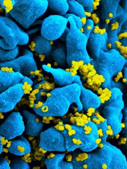 sida virus VIH anticorps