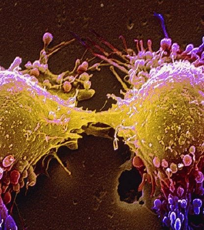 cellules cancereuses autodestruction traitement oncologie