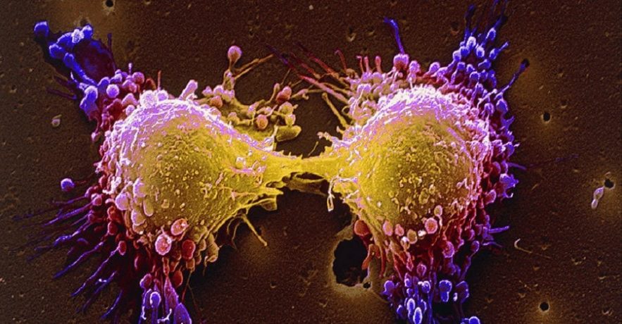 cellules cancereuses autodestruction traitement oncologie