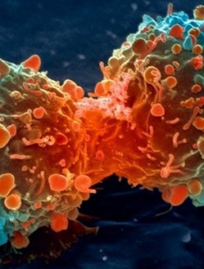 cancer cellule cancéreuse traitement fda
