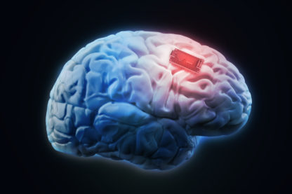 cerveau augmentation boost mémoire implant