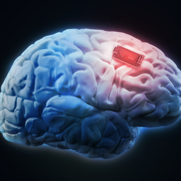 cerveau augmentation boost mémoire implant
