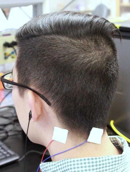 test essai clinique humain oreille acouphene stimuli electrique cerveau