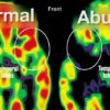 cerveau traumatisme comparaison pet scan