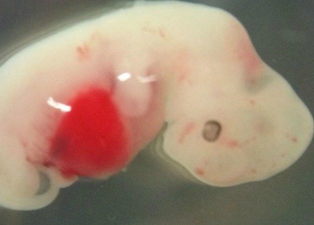 humain cochon homme hybride embryon organes