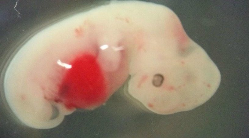 humain cochon homme hybride embryon organes