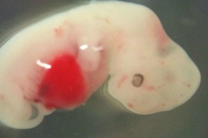 humain cochon homme hybride embryon organes