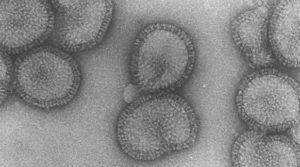 influenza virus microscopie electronique