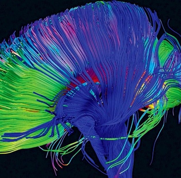 cerveau lsd psychédélique drogue harmoniser cerveau connexion neurones
