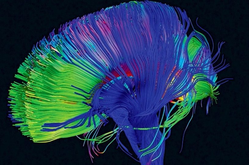 cerveau lsd psychédélique drogue harmoniser cerveau connexion neurones