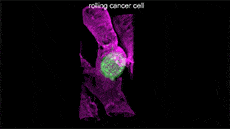 cellule cancer