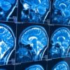 liquide sang cerveau decouverte