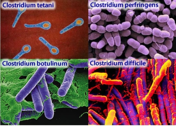 clostridium botulinum tetani toxines
