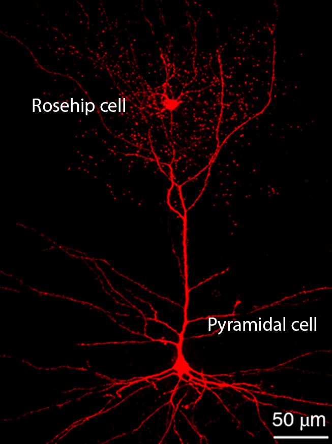 cellules neurones cerveau