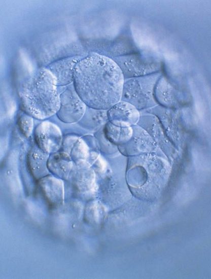 modification embryon bebe genetique genetiquement genes crispr crispr-cas9
