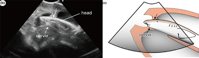 bebe embryon requin cannibale cannibalisme intra-utérin utérus