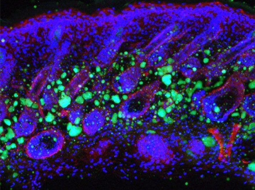 cellule cellules peau immunite perte graisse
