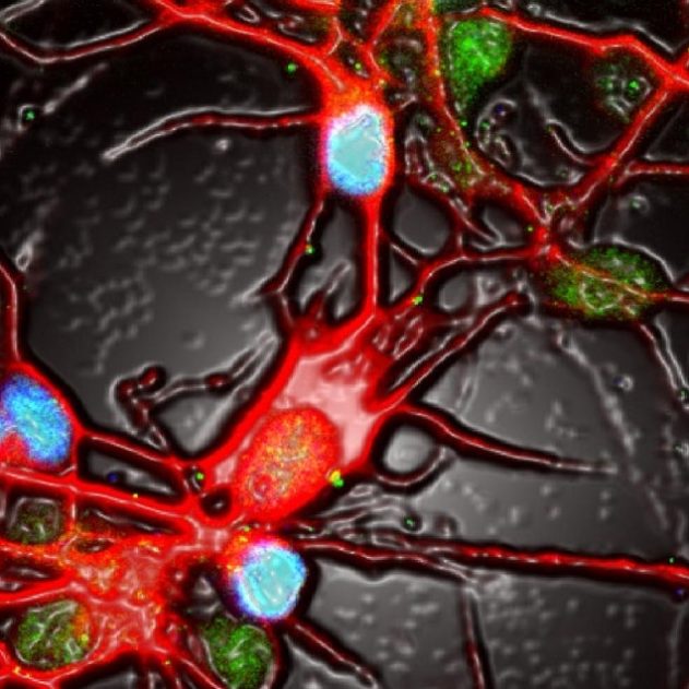 neurones activite depression