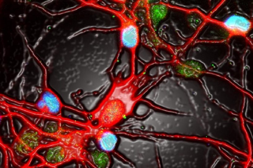 neurones activite depression
