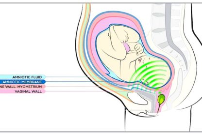 babypod schema