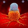 cellule cancer immunotherapie