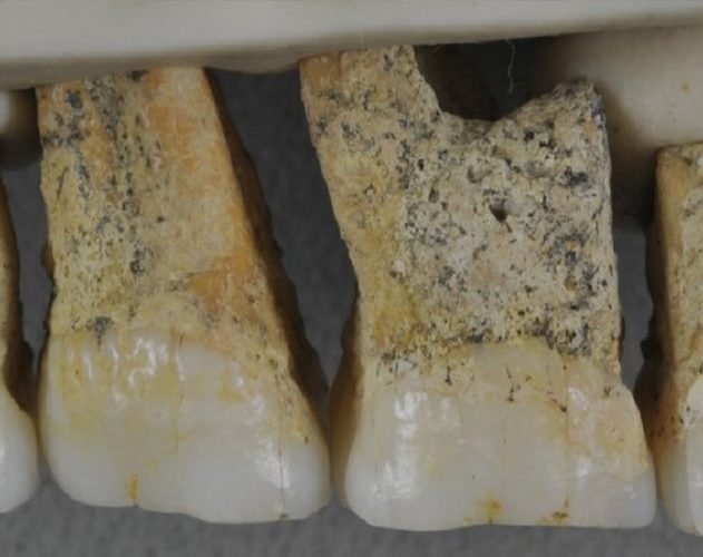 dents homo luzonensis