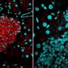 cellules cancereuses barriere