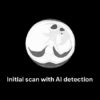 google ia irm diagnostic cancer poumon