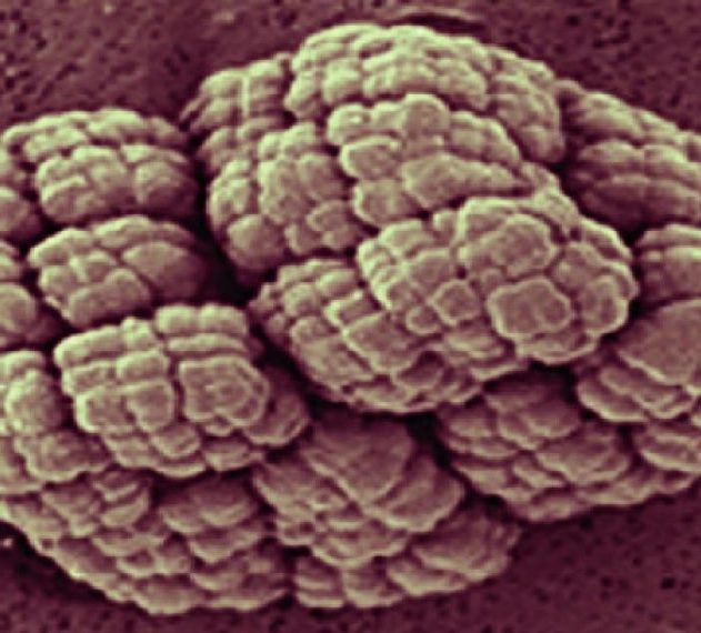 bacterie keinococcus radiotolerans