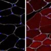 cellules souches modifies genetiquement