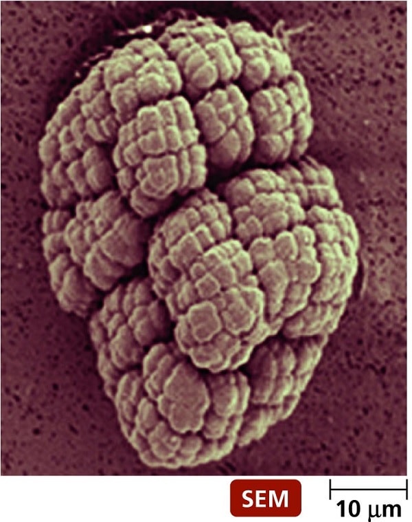 microscope keinococcus radiotolerans