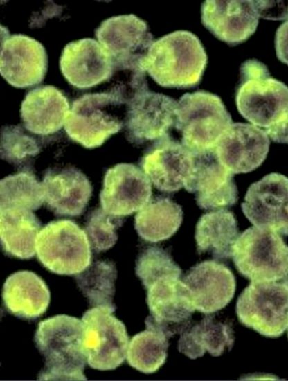 tissu infecte par naegleria fowleri