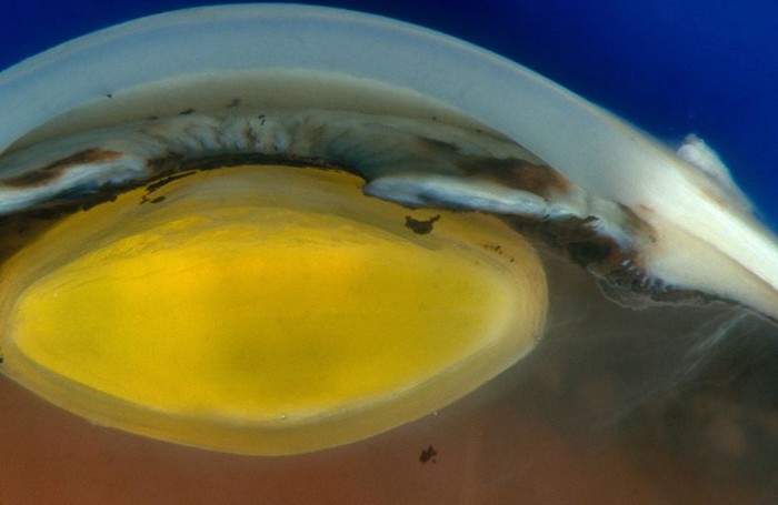 cornee oeil yeux maladie cellule souche pluripotente induite