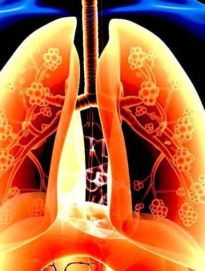 graisse poumons lien asthme decouverte