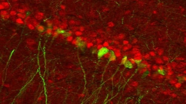 neurones depression