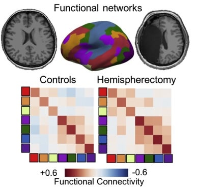 connectivite hemisphere