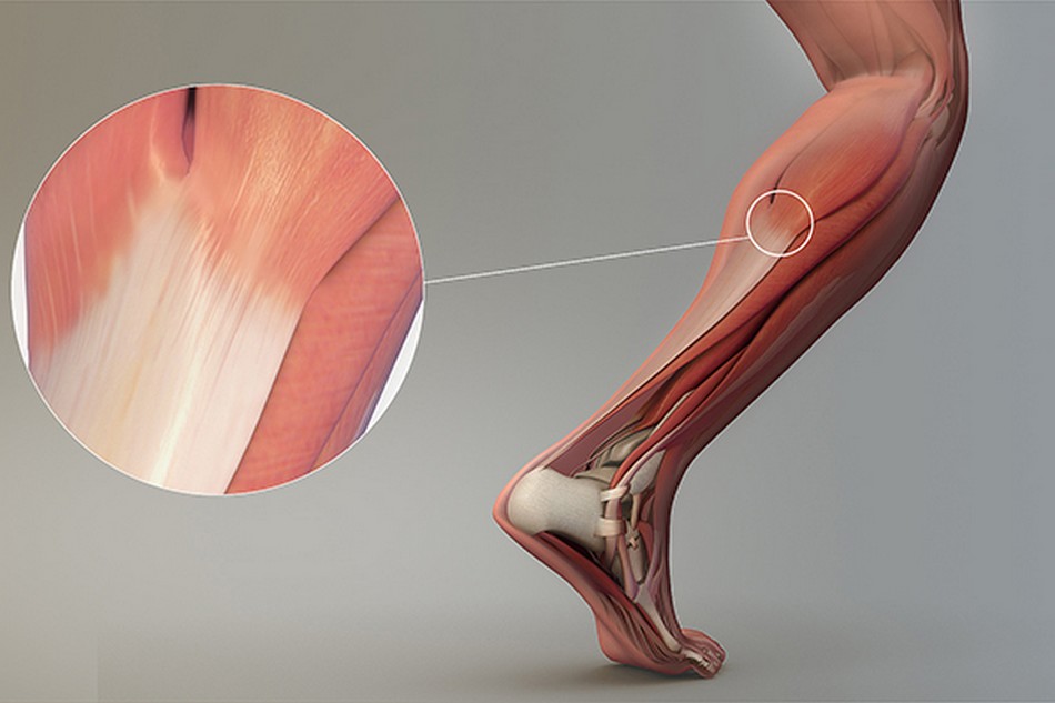 https://trustmyscience.com/wp-content/uploads/2019/11/tendons-muscles.jpg