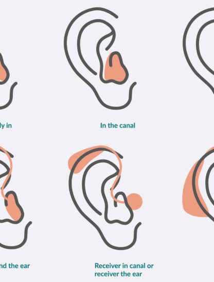 types appareils auditifs