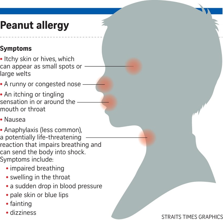 allergie arachides