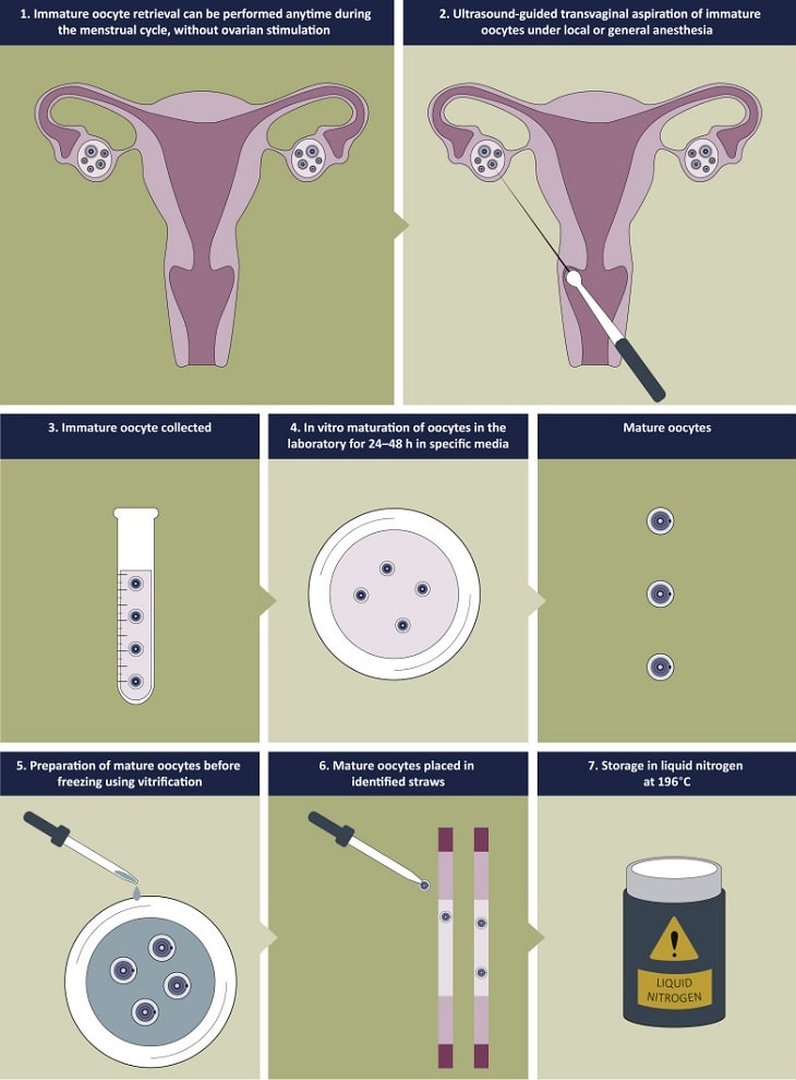 procedure ovules