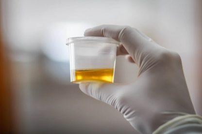 urine alcool
