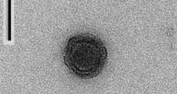 yaravirus microscope
