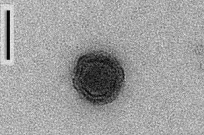 yaravirus microscope