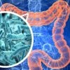 bacteries intestinales retrouvees organes personnes obeses